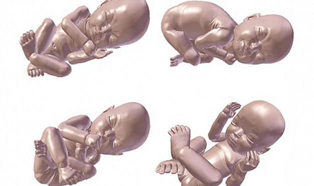 3D-model af dit ufødte barn. Uhyggeligt, smukt eller bare naturlig teknologisk udvikling?
